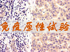 HJC黄金城平台免疫原性试验服务