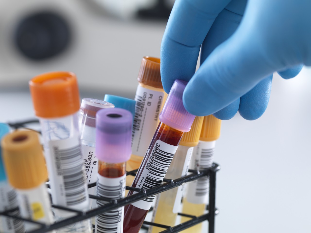 “溶出”还是“BE”，何为临床疗效“金标准”