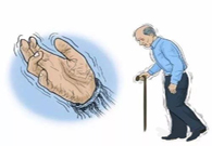 帕金森。芭痢辈慌？