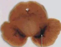 正常人：正：谥