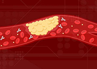 【Science速递】攻克COVID-19里程碑：已确定血凝块形成原因！