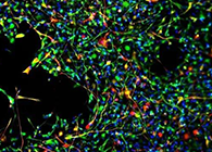 世界首创：药物将干细胞引导至受损部位，提高其愈合能力！