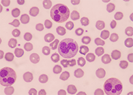 一种神秘颗粒被发现了！它能否成为败血症早筛标志物？