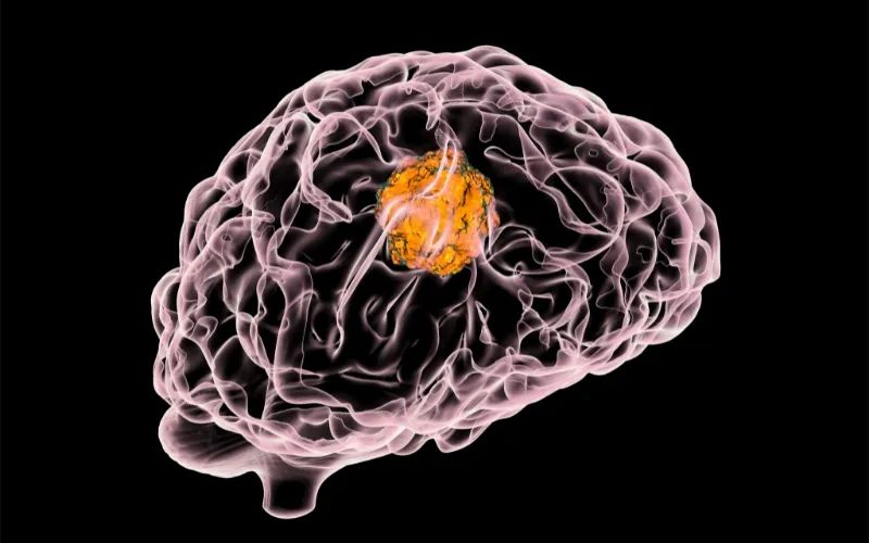 HJC黄金城平台助力 | 璧辰医药ABM-1310获美国FDA孤儿药资格认证，用于治疗携带BRAF V600突变的脑胶质母细胞瘤患者